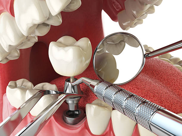 Best Same-Day Emergency Dental Services in Mountain House, CA